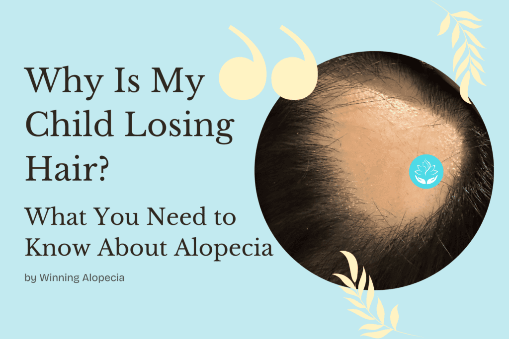 Why Is My Child Losing Hair? What You Need to Know About Alopecia