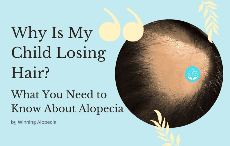 Why Is My Child Losing Hair? What You Need to Know About Alopecia